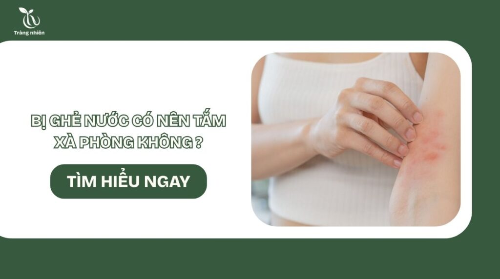 Bị ghẻ nước có nên tắm xà phòng