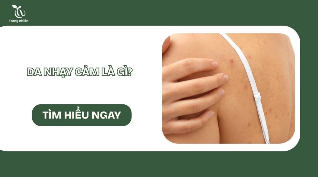 Da nhạy cảm là gì