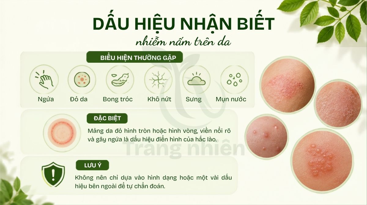 Dấu hiệu da bị nhiễm nấm